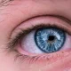 What Is 'Ferritin Face'? Signs Of Iron Deficiency Explained