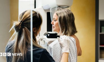 Healthcare professional wearing white examination gloves positioning a patient in a medical gown for a breast imaging scan using mammography equipment in a clinical setting.