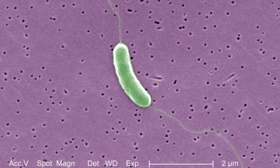 What to Know About Flesh-Eating Bacteria Vibrio Vulnificus