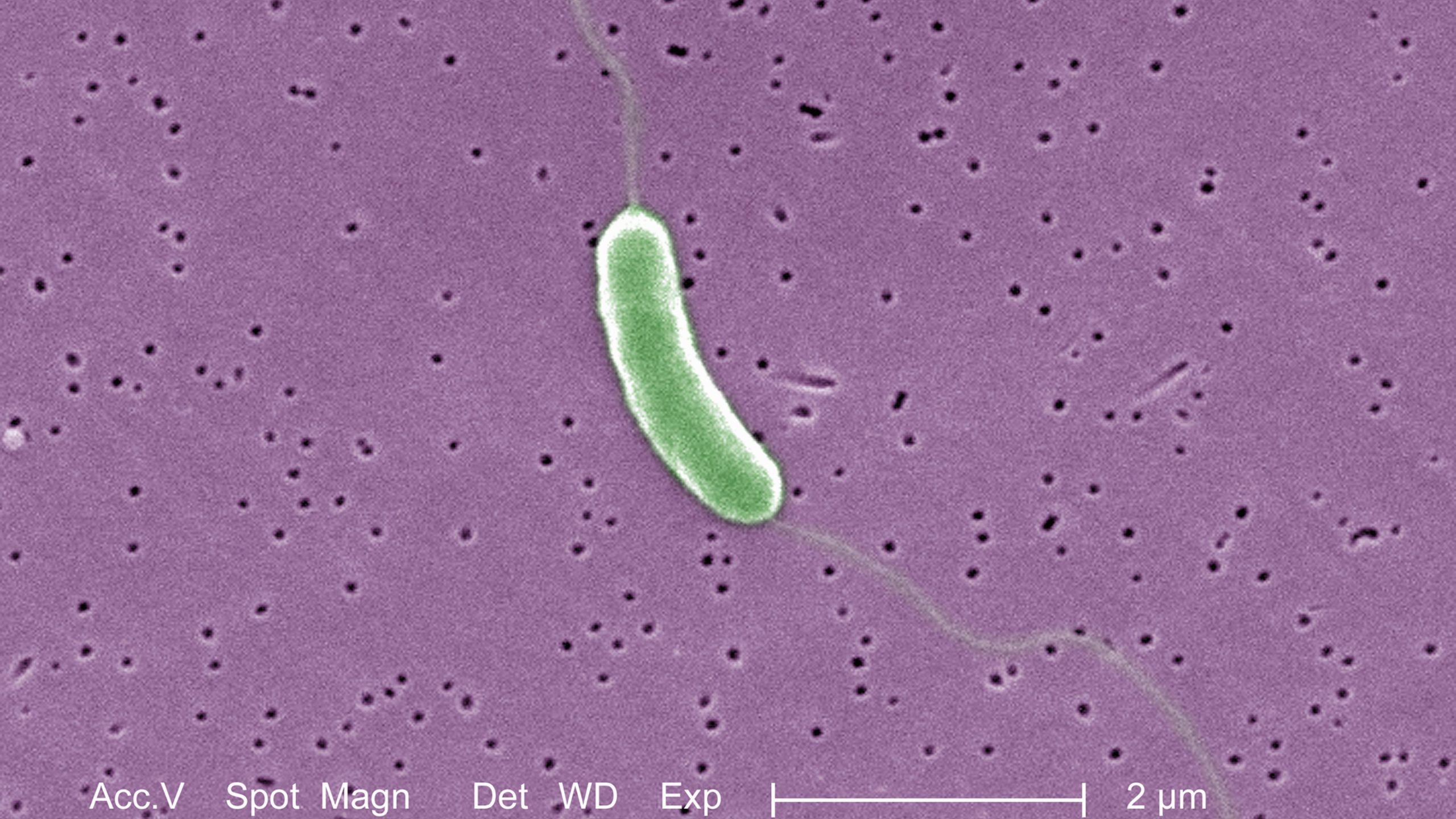 What to Know About Flesh-Eating Bacteria Vibrio Vulnificus