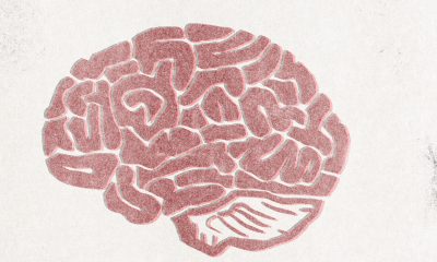 Estrogen Therapy May Help Protect Against Alzheimer’s Disease, Study Says