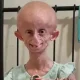 TikTok Star Beandri Booysen Dies at 19 From Rare Aging Disease