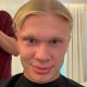 Erling Haaland Ditches Iconic Viking Ponytail for Buzz Cut Ahead