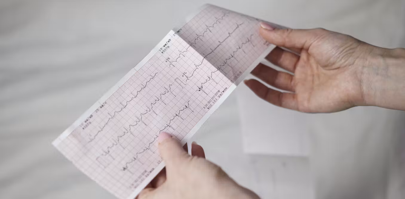What is sudden adult death syndrome?