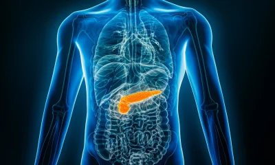 Tango Therapeutics: Promising Early Data, But A Long Road Ahead
