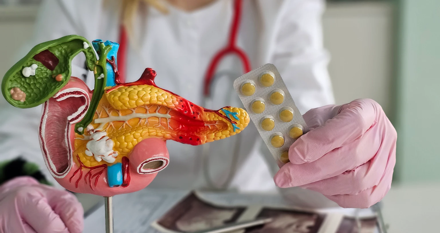 Doctor holds a model of the pancreas and a blister pack of medication in a clinic