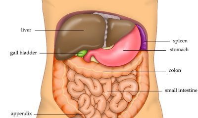 Ketogenic Diet Outperforms Other Plans for Reversing Prediabetes and Fatty