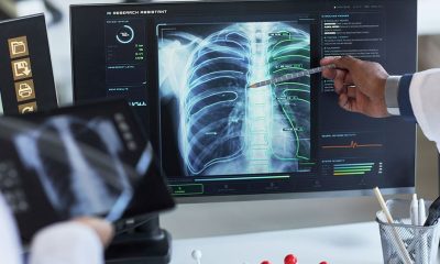 Teledyne Agrees To Buy X-Ray Company. Varex Stock Soars 48%