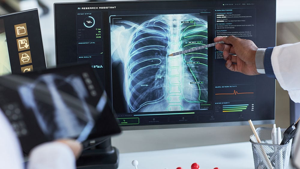 Teledyne Agrees To Buy X-Ray Company. Varex Stock Soars 48%
