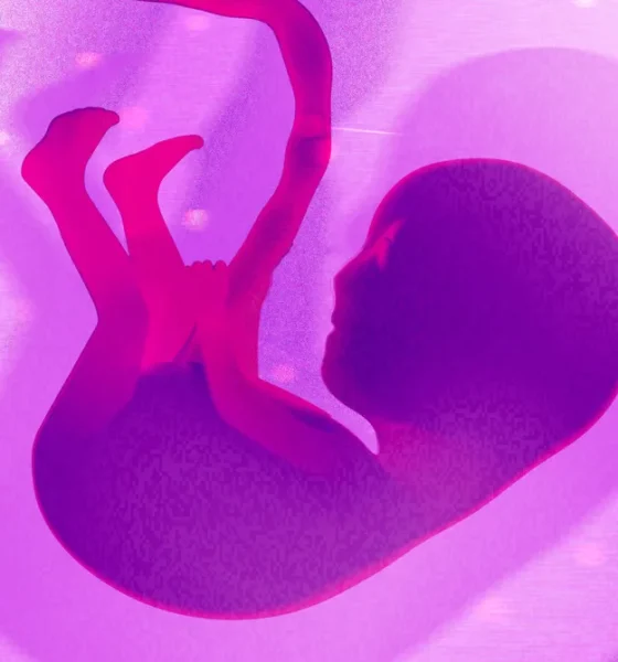 092926 Human20Embryo20Gene20Editing