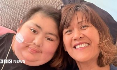 A woman and her daughter, sitting next to each other and smiling into a camera. The daughter, left, has short hair and has a tube inserted into her nose, which is taped to her face.