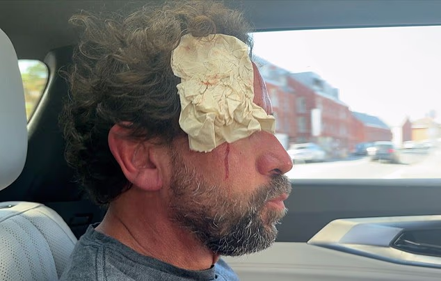 The BBC's cameraman, Pol, was struck above the eye and was later given 'a few stitches' - after the crew made a quick getaway as they were chased to their car