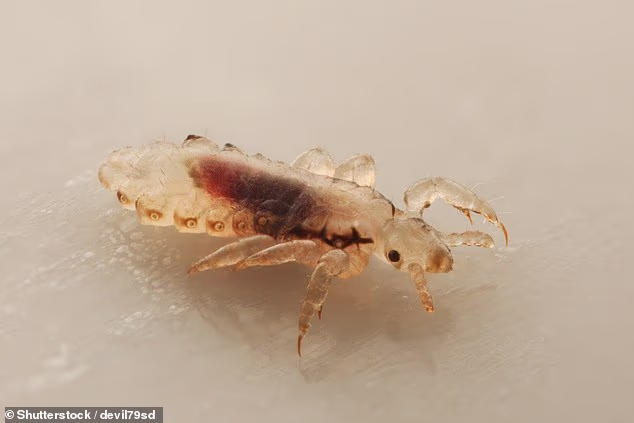 Head lice are tiny blood-sucking insects that infest the hair and scalp, where they feed and lay eggs close to the skin