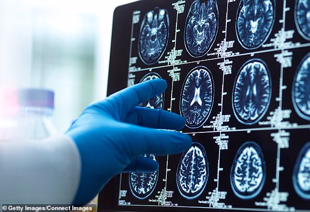 A breakthrough brain cancer test can give patients a diagnosis in less than two hours ¿ dramatically cutting the agonising wait for answers