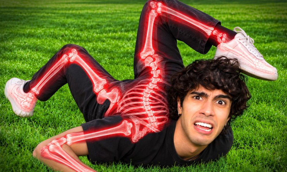 I Broke 9,243,543 Bones..