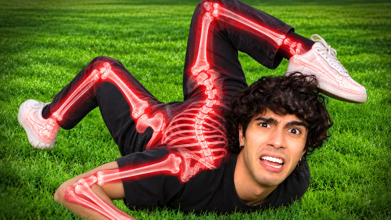 I Broke 9,243,543 Bones..