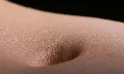 Bellybutton Smell May Show Parkinson's Or Cognitive Decline