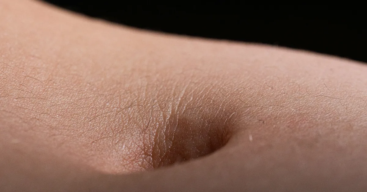 Bellybutton Smell May Show Parkinson's Or Cognitive Decline