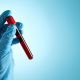 Who Should Get a Blood Test for Alzheimer's Disease?