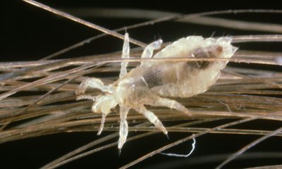 It's Head Lice Season. Here's What to Know