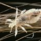 It's Head Lice Season. Here's What to Know