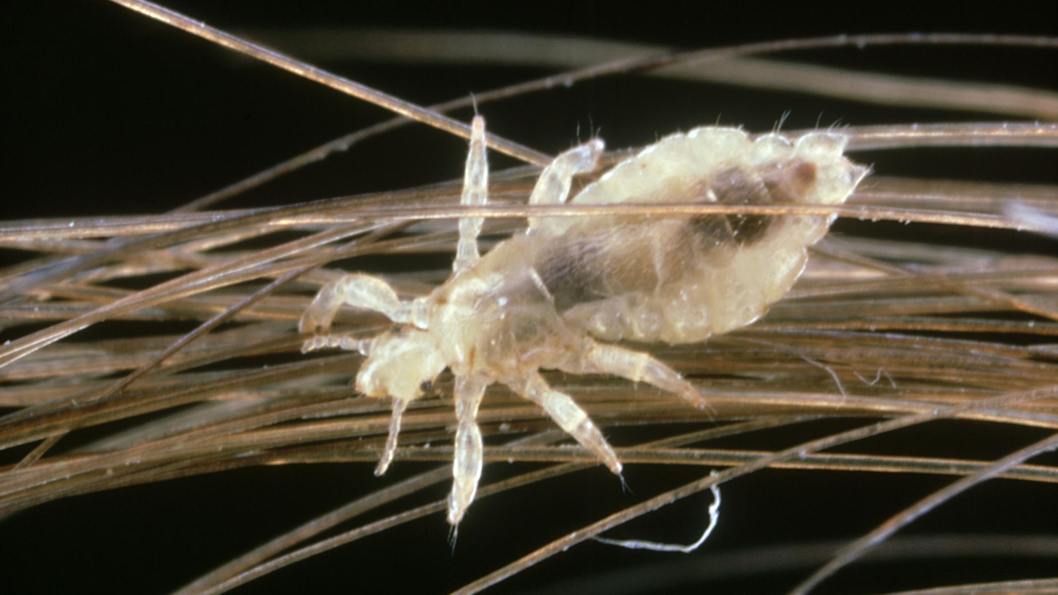 It's Head Lice Season. Here's What to Know