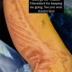 Nicole Scherzinger Shares Gruesome Pic After ‘Boiling’ Water Fell on Her Leg: ‘Show Must Go On’