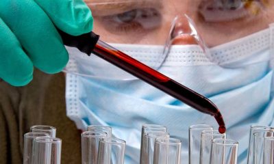 Novartis Stock Dives After Ionis-Partnered Lp(a) Blocker Fails
