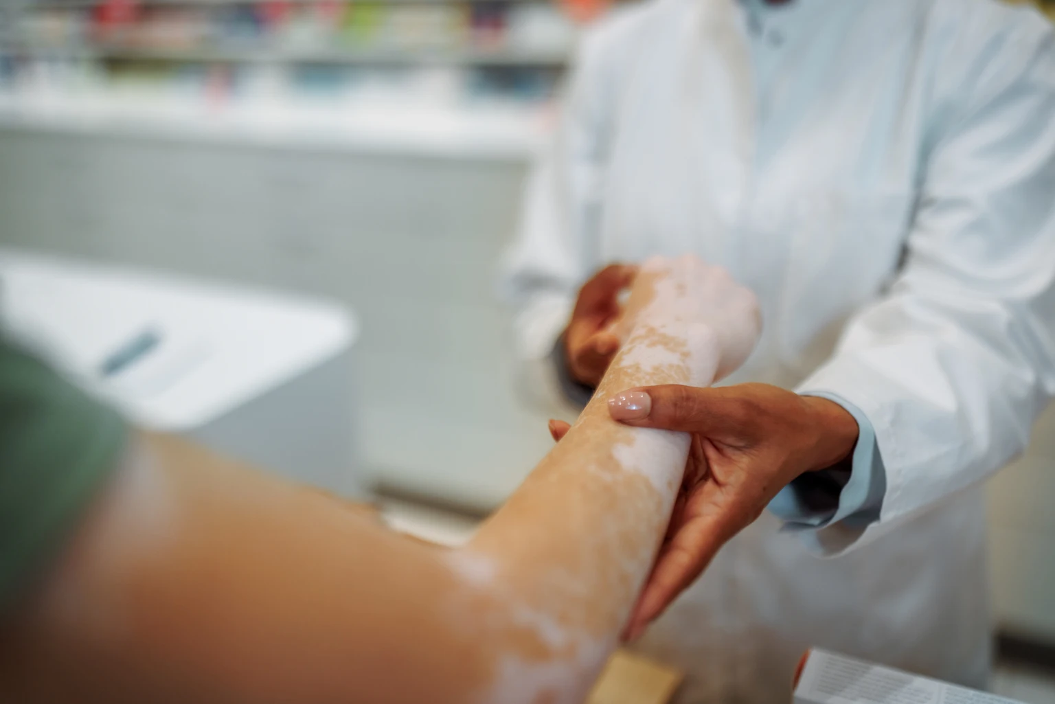 5 Reasons To Buy Clinuvel Pharmaceuticals After Its Nasdaq Uplisting