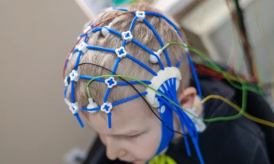 Xenon: Epilepsy Got It To $59; Depression Has To Take It From Here (NASDAQ:XENE)