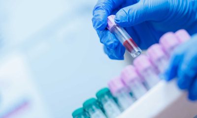 How Automation Helps Improve Sample Processing in Research