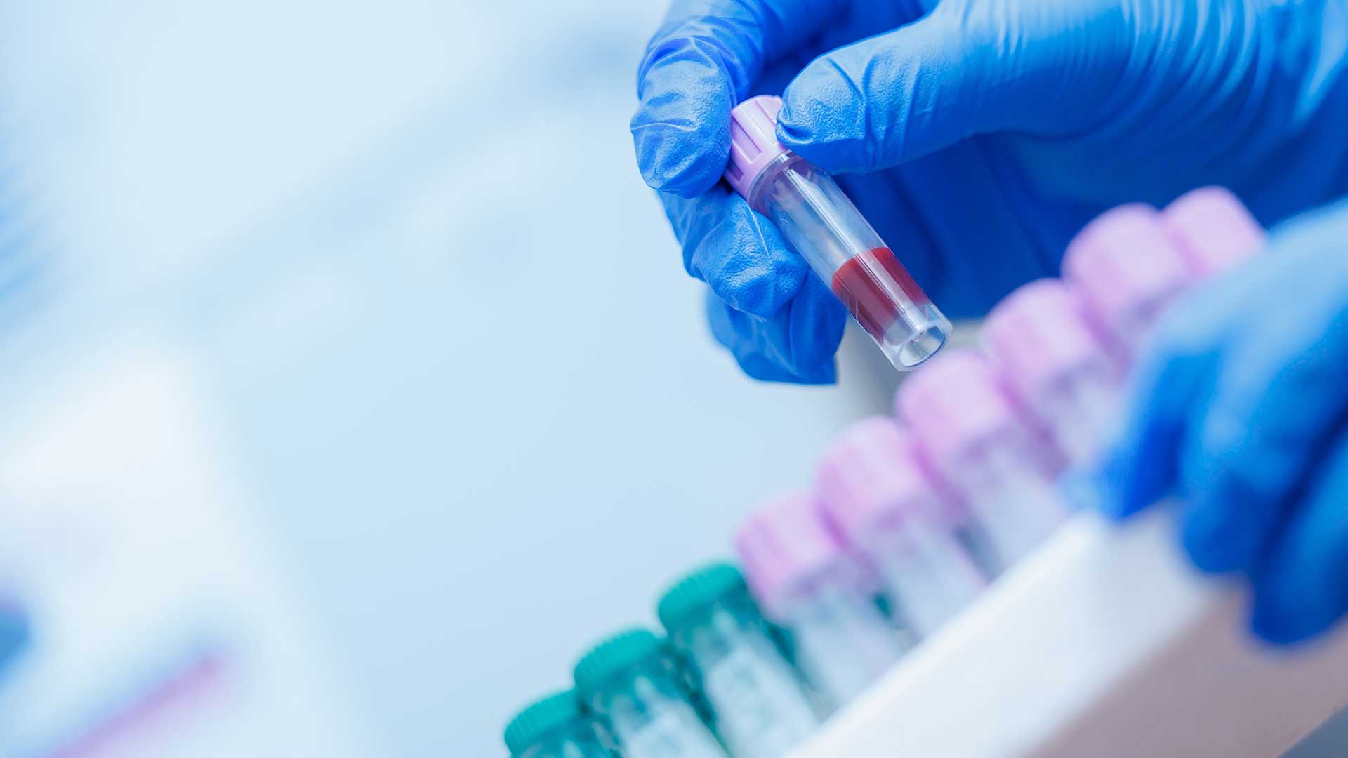 How Automation Helps Improve Sample Processing in Research