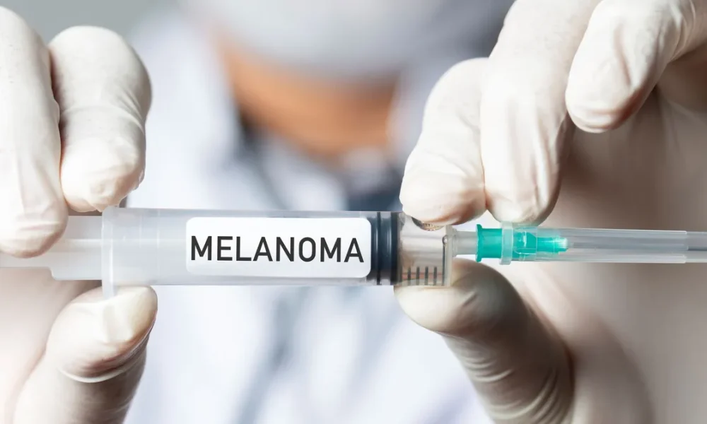 vacuna20melanoma202275195271