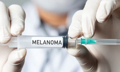 vacuna20melanoma202275195271