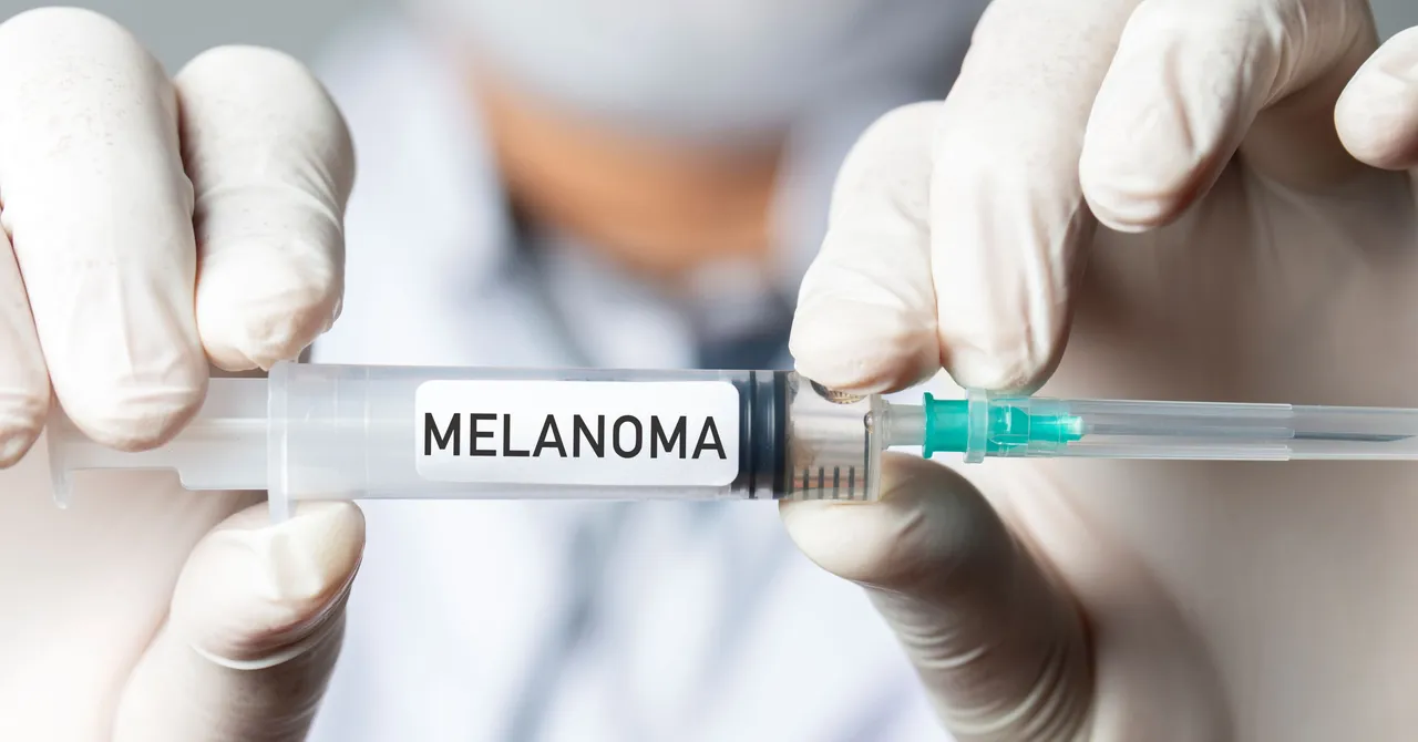vacuna20melanoma202275195271
