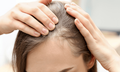 Hairline Transplant: Procedure, Cost, Recovery, and Results